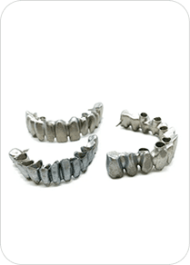 Prothèse dentaire métallique imprimée en 3D