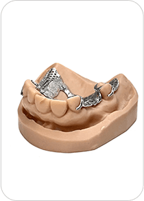 Couronne dentaire en titane