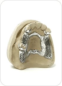 Bridge dentaire métallique complet