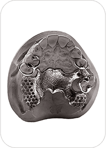 Implant dentaire personnalisé